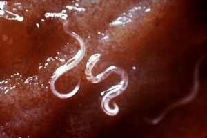 hookworms and autoimmunity